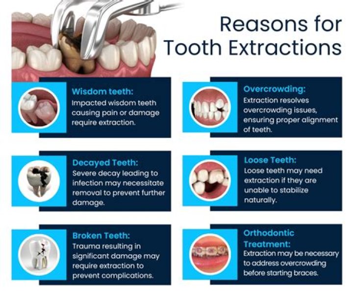What is the hardest tooth to extract?
