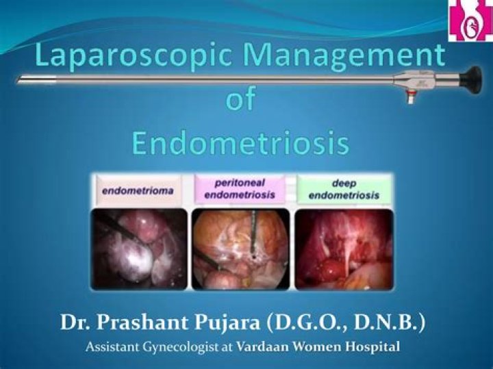 Which is worse adenomyosis or endometriosis?