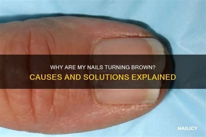 Why are my nails turning brown?
