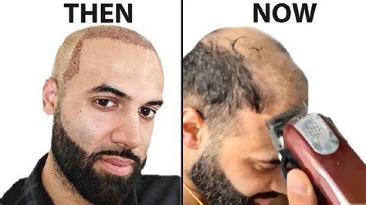 Why can I still see hair after shaving?