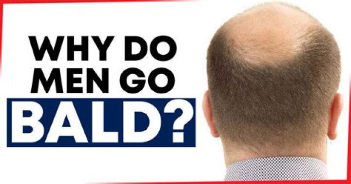 Why do men go bald?