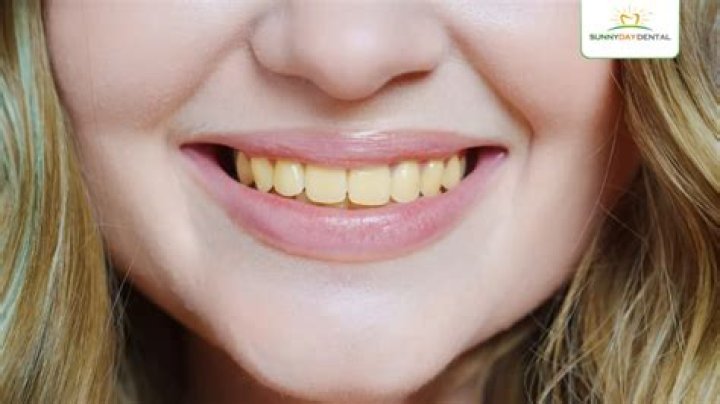 Why do people have yellow teeth?