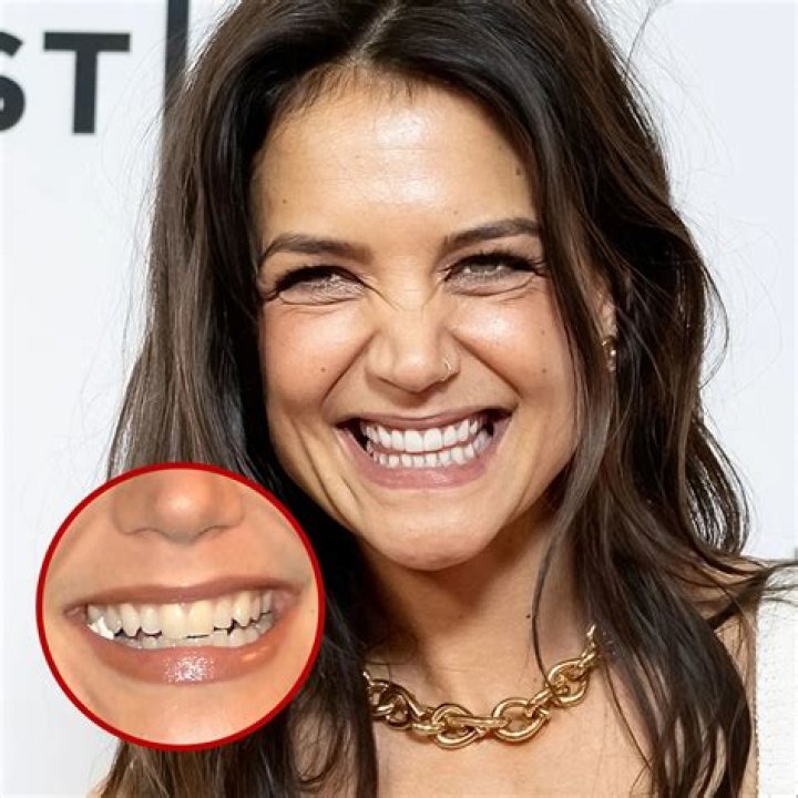 Why does everyone on TV have perfect teeth?