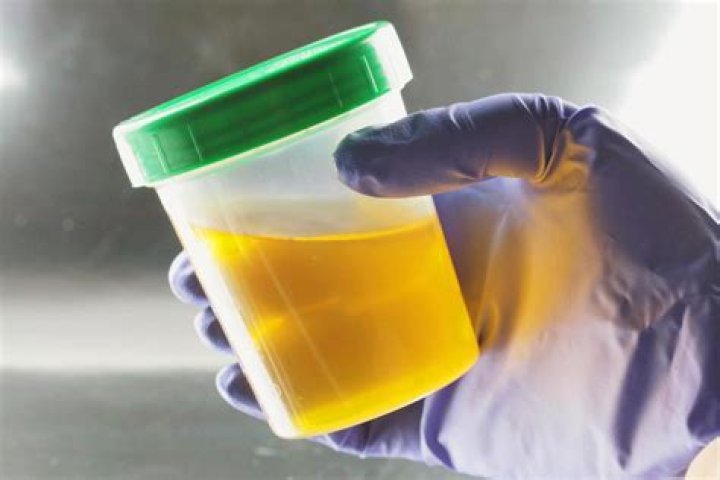 Why does my pee smell burnt?